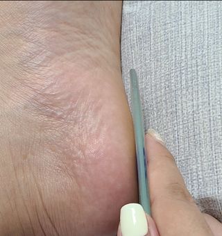 미라클풋 유리발각질제거기 물없이 쓱싹쓱싹 몇번만에 발각질 완벽제거 — 5점을 준 리뷰어가 2021년 8월 올린 사용 사진