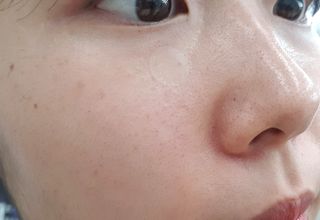 [큐어반H 스팟] 자외선 99프로 차단되는 스틱타입 스팟밴드(1팩 / 66매입) — 5점을 준 리뷰어가 2022년 11월 올린 사용 사진