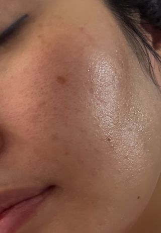 ✅프리 (블로그체험단) [밀리밀리] 메디 앰플 비타 15ml — 5점을 준 리뷰어가 2025년 9월 올린 사용 사진