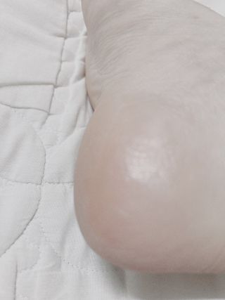 성분에디터 시어버터 아기발스틱 — 5점을 준 리뷰어가 2021년 6월 올린 사용 사진