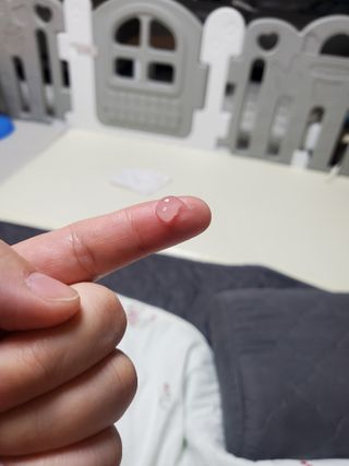 [LIVE 캠페인] 히루스카 포스트아크네 클리어 — 4점을 준 리뷰어가 2021년 3월 올린 사용 사진
