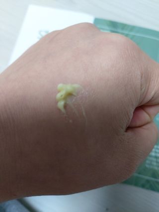 건선/아토/습진/민감성 피부 천연보습진정크림 소리온 크림 & 센시티브 크림 50g — 5점을 준 리뷰어가 2022년 1월 올린 사용 사진