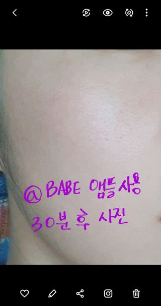 바베 BABE 바베 프로테오글리칸 F+F 앰플 솔루션 — 4점을 준 리뷰어가 2021년 1월 올린 사용 사진