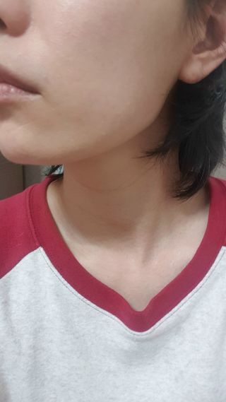 아이디플라코스메틱 아이디 페이스핏 마이너스 밴드 v2 — 4점을 준 리뷰어가 2021년 5월 올린 사용 사진