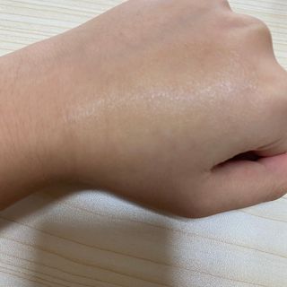 히루스카 포스트아크네 클리어 — 5점을 준 리뷰어가 2021년 1월 올린 사용 사진