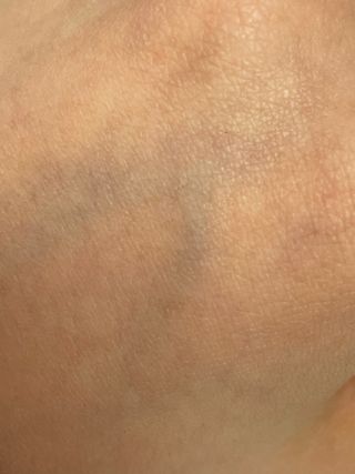 피지오겔 사이언수티컬즈 더 링클-스탑 백 앰플 세럼 — 5점을 준 리뷰어가 2022년 4월 올린 사용 사진