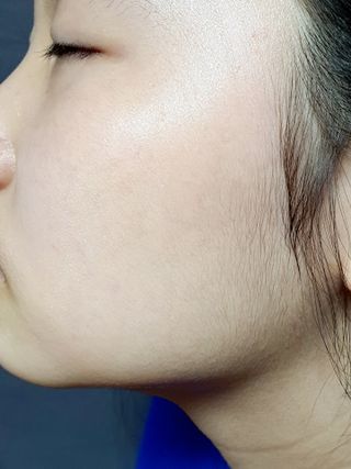 리더스코스메틱 리더스 카밍 바이오틱스 에센스 워터 — 4점을 준 리뷰어가 2021년 3월 올린 사용 사진