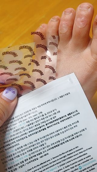 에버렐 아크네 클리어 패치 오리지널(40매) + XL(8매) 1세트, 각 1개씩 — 5점을 준 리뷰어가 2022년 5월 올린 사용 사진