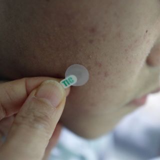 [큐어반H 스팟] 자외선 99프로 차단되는 스틱타입 스팟밴드(1팩 / 66매입) — 5점을 준 리뷰어가 2022년 12월 올린 사용 사진