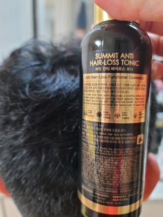 썸헤어 / SUMHAIR 썸헤어 써밋 안티 헤어로스 토닉 — 5점을 준 리뷰어가 2021년 5월 올린 사용 사진