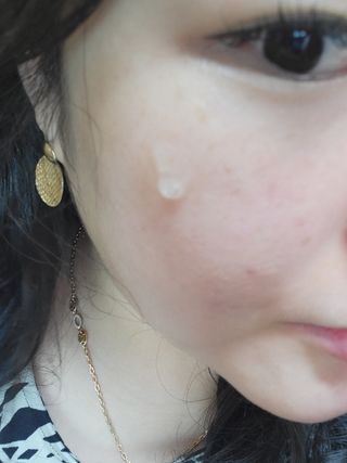 체르엠 스템앤셀 비타민 브라이트닝 에센스 30ml 1개 — 5점을 준 리뷰어가 2021년 9월 올린 사용 사진