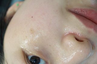 태그스킨 4스텝 주름개선 피부미백 영양 마스크팩 3개 세트(최신버전) — 5점을 준 리뷰어가 2022년 5월 올린 사용 사진