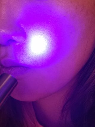 메데스 비츠케어 모공케어 피부관리키트 — 4점을 준 리뷰어가 2021년 8월 올린 사용 사진