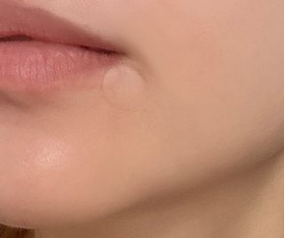 세뚜아(Cettua) 세뚜아 스팟 클리어 듀얼 패치 Cettua Spot Clear Dual Patch — 5점을 준 리뷰어가 2023년 9월 올린 사용 사진