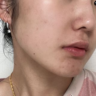 A.C PROMISE LINE 임상시험회사에서 제대로 만든, 민감성피부를 위한 트러블 기초라인 — 4점을 준 리뷰어가 2023년 8월 올린 사용 사진