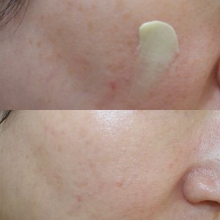 건선/아토/습진/민감성 피부 천연보습진정크림 소리온 크림 & 센시티브 크림 50g — 5점을 준 리뷰어가 2022년 1월 올린 사용 사진