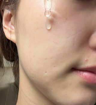 나우 [리브엠] 화해 1등 진정 앰플, 엑소코어 카밍 텐션 앰플 — 5점을 준 리뷰어가 2023년 6월 올린 사용 사진
