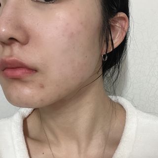 약손명가코스메틱 에오스보떼 아쿠아 모이스처라이징 워터 크림 — 4.5점을 준 리뷰어가 2022년 1월 올린 사용 사진