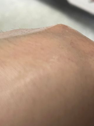 닥터에프파이브 시카페이트 카밍 앰플샷 15ml — 5점을 준 리뷰어가 2022년 6월 올린 사용 사진