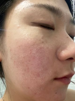 스킨1004 [SKIN1004] 마다가스카르 센텔라 라이트 클렌징 오일 200ml — 5점을 준 리뷰어가 2024년 8월 올린 사용 사진