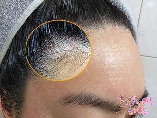 방방곳곳 편림초 마이크로바이옴 샴푸 — 4점을 준 리뷰어가 2022년 6월 올린 사용 사진