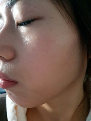 바이리뮤 에이지 홀딩 펩타톡스 앰플 — 5점을 준 리뷰어가 2020년 12월 올린 사용 사진