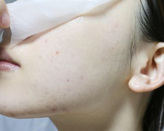 체르엠 그린 케비어 더블워터 마스크팩 5매입  2팩 — 4.5점을 준 리뷰어가 2021년 12월 올린 사용 사진