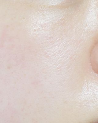 리더스코스메틱 리더스 퍼스트 샷 에센스 스틱 2종 — 5점을 준 리뷰어가 2022년 4월 올린 사용 사진