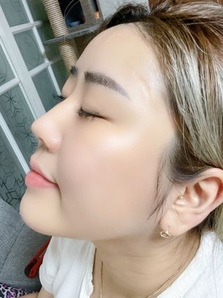 바베 BABE 바베 프로테오글리칸 F+F 앰플 솔루션 — 5점을 준 리뷰어가 2021년 1월 올린 사용 사진