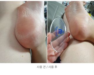 미라클풋 유리발각질제거기 물없이 쓱싹쓱싹 몇번만에 발각질 완벽제거 — 5점을 준 리뷰어가 2021년 8월 올린 사용 사진