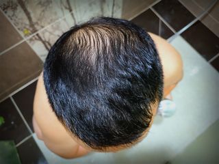 MOAMANEMUNAH 모아만에무나 플러스 두피 탈모 완화 기능성 샴푸 + 브러쉬 2종 세트 — 5점을 준 리뷰어가 2021년 10월 올린 사용 사진
