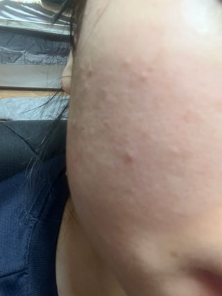 스킨큐어 산다화 비타민c 화이트닝 에센스 30ml — 5점을 준 리뷰어가 2023년 12월 올린 사용 사진