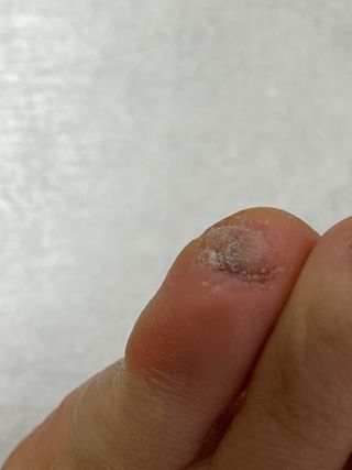 여름님이 올린 리뷰 사진 2