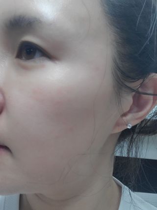 체르엠 그린 케비어 더블워터 마스크팩 5매입  2팩 — 5점을 준 리뷰어가 2021년 12월 올린 사용 사진