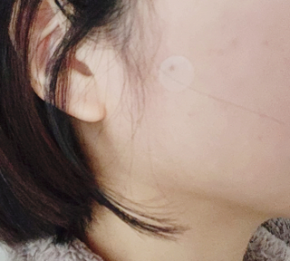 [큐어반H 스팟] 자외선 99프로 차단되는 스틱타입 스팟밴드(1팩 / 66매입) — 4.5점을 준 리뷰어가 2022년 12월 올린 사용 사진