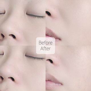 리더스코스메틱 리더스 카밍 바이오틱스 에센스 워터 — 3.5점을 준 리뷰어가 2021년 2월 올린 사용 사진