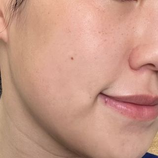 태그스킨 4스텝 주름개선 피부미백 영양 마스크팩 3개 세트(최신버전) — 5점을 준 리뷰어가 2022년 3월 올린 사용 사진