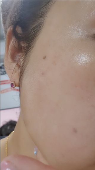 씽크바이오 히알루론 에센스 에어볼 28ea — 5점을 준 리뷰어가 2022년 9월 올린 사용 사진