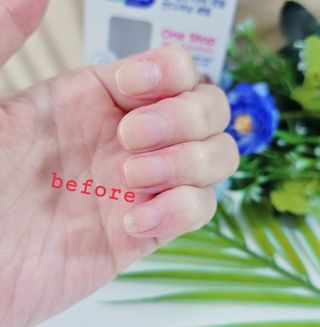 톱메드 free 더마 네일 컨디셔닝 세럼 — 5점을 준 리뷰어가 2023년 11월 올린 사용 사진