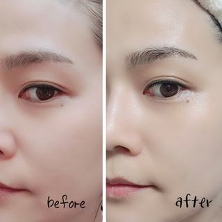 마이디플러스 아토비옴 4종 기프트 패키지 — 5점을 준 리뷰어가 2021년 11월 올린 사용 사진