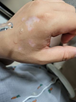 렉스리 닥터 올인원 세럼 Rexri Dr.All-in-one Serum — 5점을 준 리뷰어가 2022년 6월 올린 사용 사진