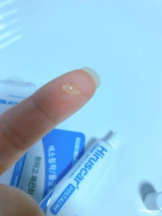 히루스카 포스트아크네 클리어 — 4.5점을 준 리뷰어가 2021년 2월 올린 사용 사진
