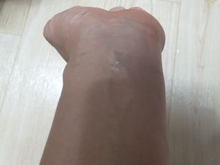 바이오오일 [바이오-오일] 스킨케어 오일 내추럴 60ml — 4.5점을 준 리뷰어가 2021년 10월 올린 사용 사진