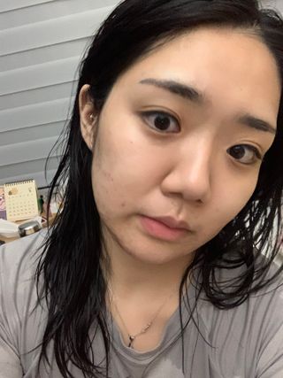 베지톨로지 비니페린 브라이트닝 앰플 — 5점을 준 리뷰어가 2022년 8월 올린 사용 사진