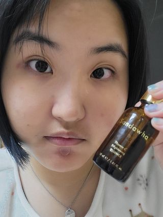 스킨큐어 산다화 비타민c 화이트닝 에센스 30ml — 5점을 준 리뷰어가 2023년 12월 올린 사용 사진