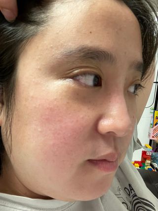 아이디플라코스메틱 아이디 페이스핏 마이너스 앰플 — 5점을 준 리뷰어가 2022년 3월 올린 사용 사진