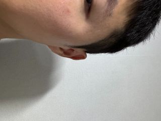 키리아 테라피 N[키라아 테라피] 마레 푸코오스 모이스트 퍼밍 앰플 50g — 5점을 준 리뷰어가 2024년 8월 올린 사용 사진