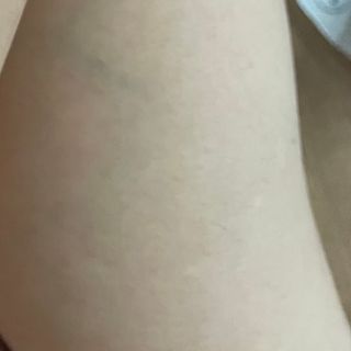 피비에스코리아 [오마이셀프] 셀프왁싱키트 — 4.5점을 준 리뷰어가 2021년 11월 올린 사용 사진