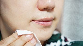생크몽드 피토 필링 로션 150ml — 3.5점을 준 리뷰어가 2021년 9월 올린 사용 사진