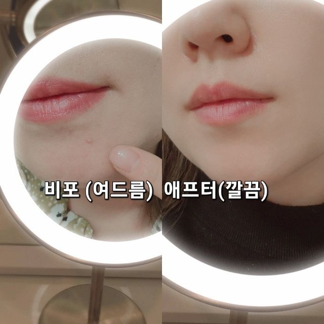 에버렐 아크네 클리어 패치 오리지널(40매) 2개 세트 리뷰 사진